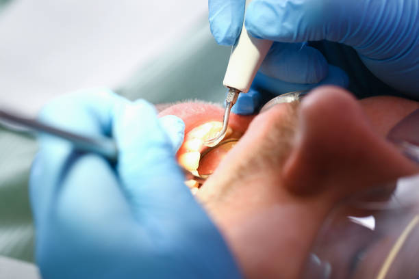 Best Knocked-Out Tooth Emergency  in Palisades Park, NJ