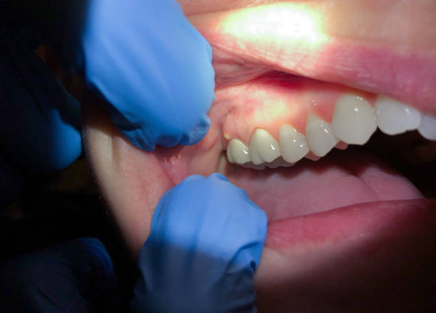 Best Urgent Tooth Repair  in Palisades Park, NJ